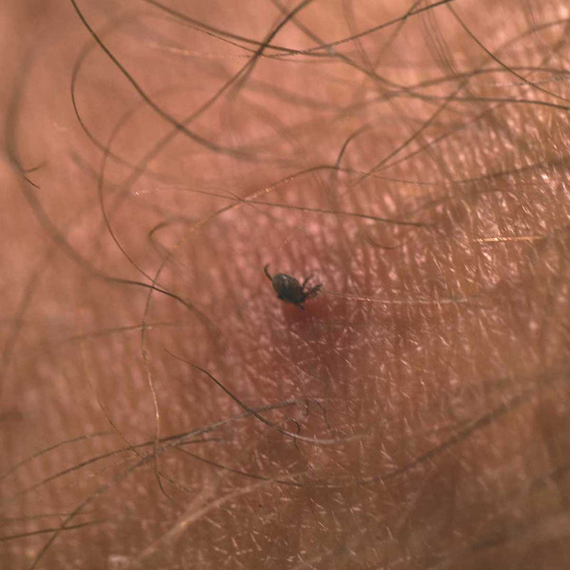Load image into Gallery viewer, Tick Remover Card
